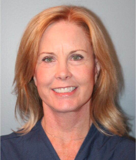 After — 55-64 year old woman treated with Lower Face Lift