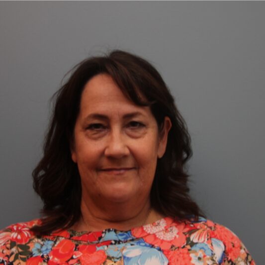 Before — 61 year old woman treated with LiteLift® Facelift