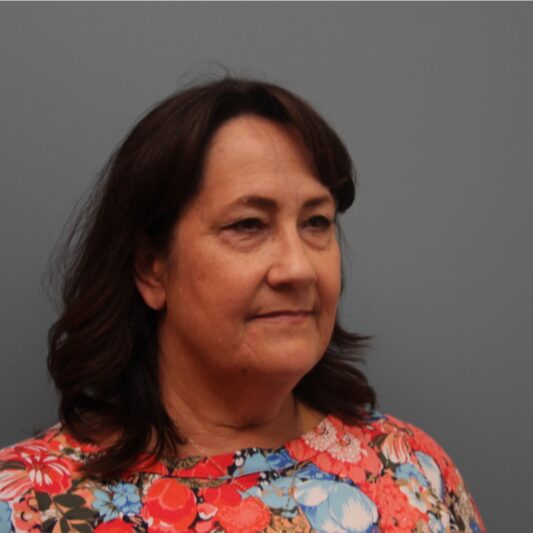 Before — 61 year old woman treated with LiteLift® Facelift