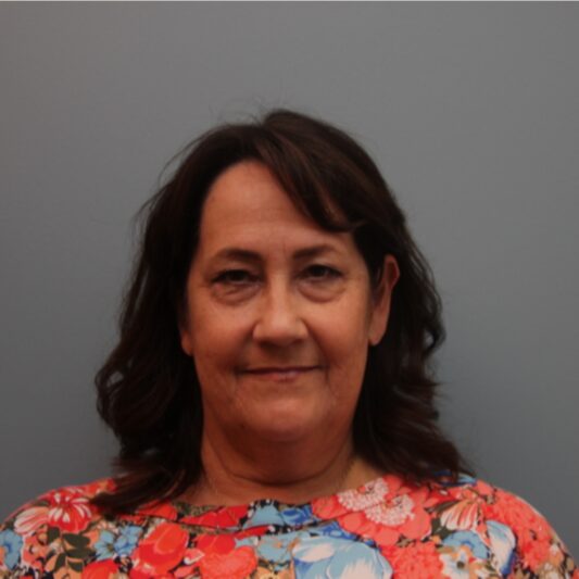 Before — 61 year old woman treated with SMAS Facelift
