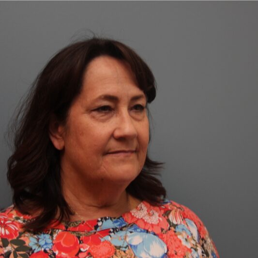 Before — 61 year old woman treated with Eyelid Surgery