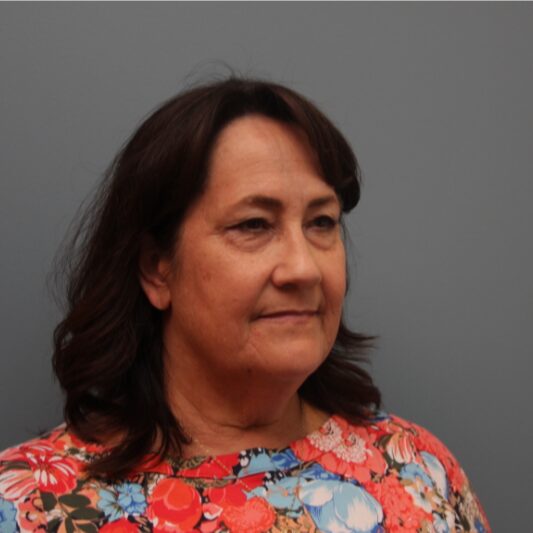 Before — 61 year old woman treated with Eye Bags Treatment