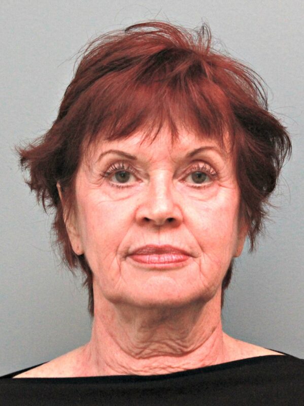 Before — 68 year old woman treated with MACS Facelift